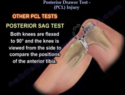 test for pcl tear|pcl injury manual tests.